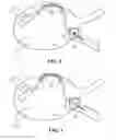 Fig. 05 - Multifunctional ablation device
