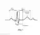 Fig. 09 - Timed energy delivery