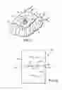 Fig. 07 - Incise drape for surgical applications and method of positioning the drape over a patient