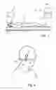 Fig. 02 - Stereotactic surgical instrument