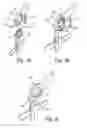 Fig. 03 - Stereotactic surgical instrument