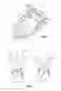 Fig. 02 - Evaluating prosthetic heart valve placement