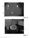 Fig. 07 - Evaluating prosthetic heart valve placement