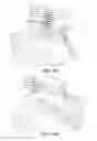 Fig. 09 - Evaluating prosthetic heart valve placement