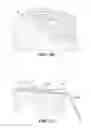 Fig. 10 - Evaluating prosthetic heart valve placement