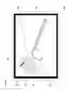 Fig. 07 - IMAGE ANNOTATION IN IMAGE-GUIDED MEDICAL PROCEDURES