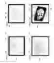 Fig. 09 - IMAGE ANNOTATION IN IMAGE-GUIDED MEDICAL PROCEDURES