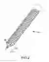 Fig. 03 - Image-guided minimal-step placement of screw into bone