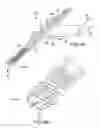 Fig. 06 - Image-guided minimal-step placement of screw into bone