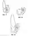 Fig. 09 - Method and apparatus for orthodontic attachment fabrication and placement