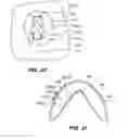 Fig. 10 - Method and apparatus for orthodontic attachment fabrication and placement