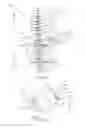 Fig. 03 - Implants for enhanced anchoring within bone
