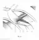 Fig. 04 - Implants for enhanced anchoring within bone