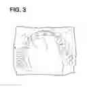 Fig. 04 - Metal Bite Strip
