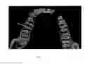 Fig. 02 - SYSTEMS, APPARATUSES AND METHODS FOR IMPROVED TOOTH IMPLANT