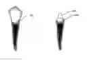 Fig. 07 - SYSTEMS, APPARATUSES AND METHODS FOR IMPROVED TOOTH IMPLANT
