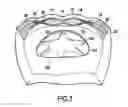 Fig. 03 - IMPLANTABLE PROSTHESIS