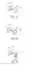 Fig. 05 - ENDOLUMINAL FILTER DESIGN VARIATIONS