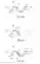 Fig. 06 - ENDOLUMINAL FILTER DESIGN VARIATIONS
