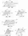 Fig. 17 - ENDOLUMINAL FILTER DESIGN VARIATIONS