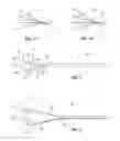 Fig. 02 - IVC FILTER RETRIEVAL SYSTEMS WITH INTERPOSED SUPPORT MEMBERS