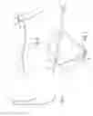 Fig. 02 - Continuous loop assembly