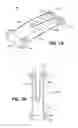 Fig. 02 - Scleral prosthesis for treating presbyopia and other eye disorders and related devices and methods