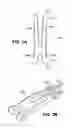 Fig. 03 - Scleral prosthesis for treating presbyopia and other eye disorders and related devices and methods
