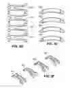 Fig. 05 - Scleral prosthesis for treating presbyopia and other eye disorders and related devices and methods