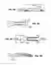 Fig. 07 - Scleral prosthesis for treating presbyopia and other eye disorders and related devices and methods