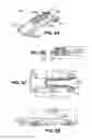 Fig. 08 - Scleral prosthesis for treating presbyopia and other eye disorders and related devices and methods