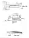 Fig. 11 - Scleral prosthesis for treating presbyopia and other eye disorders and related devices and methods