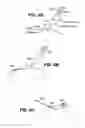 Fig. 12 - Scleral prosthesis for treating presbyopia and other eye disorders and related devices and methods