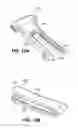 Fig. 17 - Scleral prosthesis for treating presbyopia and other eye disorders and related devices and methods