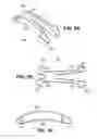 Fig. 04 - Scleral prosthesis for treating presbyopia and other eye disorders and related devices and methods