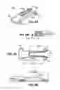 Fig. 08 - Scleral prosthesis for treating presbyopia and other eye disorders and related devices and methods
