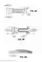 Fig. 09 - Scleral prosthesis for treating presbyopia and other eye disorders and related devices and methods