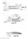 Fig. 11 - Scleral prosthesis for treating presbyopia and other eye disorders and related devices and methods