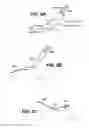 Fig. 12 - Scleral prosthesis for treating presbyopia and other eye disorders and related devices and methods