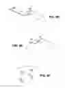 Fig. 13 - Scleral prosthesis for treating presbyopia and other eye disorders and related devices and methods