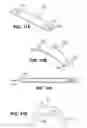 Fig. 16 - Scleral prosthesis for treating presbyopia and other eye disorders and related devices and methods