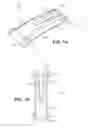Fig. 02 - Scleral prosthesis for treating presbyopia and other eye disorders and related devices and methods