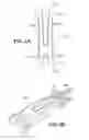 Fig. 03 - Scleral prosthesis for treating presbyopia and other eye disorders and related devices and methods