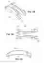 Fig. 04 - Scleral prosthesis for treating presbyopia and other eye disorders and related devices and methods