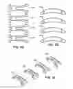 Fig. 05 - Scleral prosthesis for treating presbyopia and other eye disorders and related devices and methods