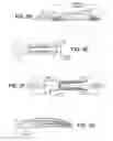 Fig. 07 - Scleral prosthesis for treating presbyopia and other eye disorders and related devices and methods