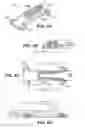 Fig. 08 - Scleral prosthesis for treating presbyopia and other eye disorders and related devices and methods