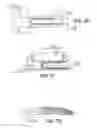 Fig. 11 - Scleral prosthesis for treating presbyopia and other eye disorders and related devices and methods