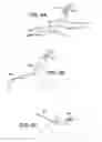 Fig. 12 - Scleral prosthesis for treating presbyopia and other eye disorders and related devices and methods