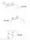 Fig. 13 - Scleral prosthesis for treating presbyopia and other eye disorders and related devices and methods
